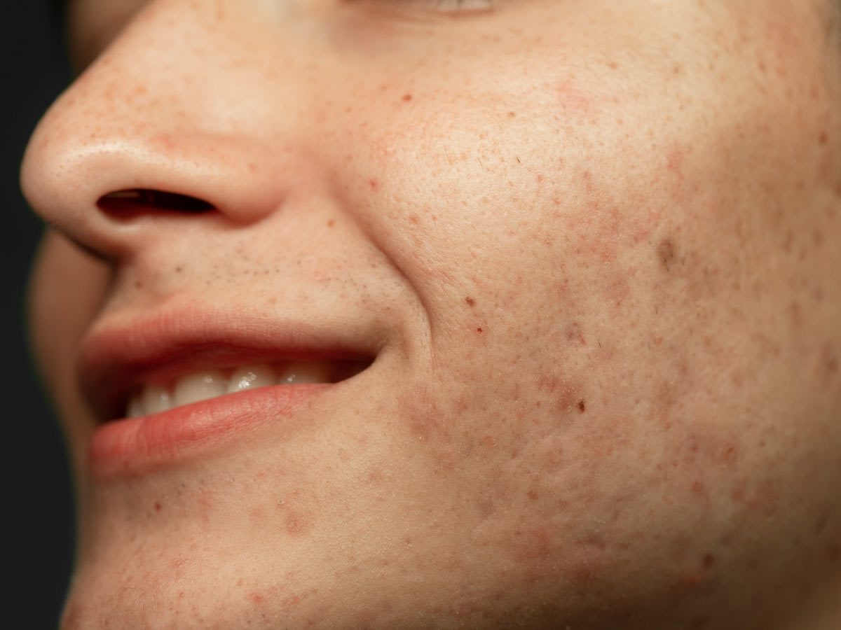 Face with skin pigmentation